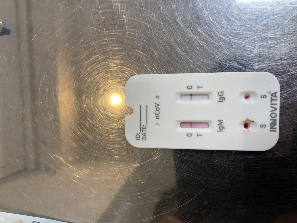 PCR検査
