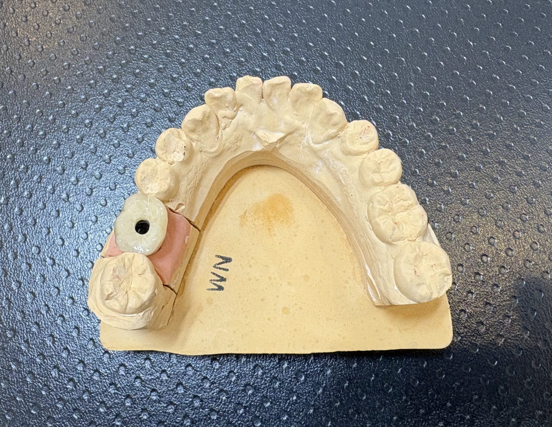 インプラント装着における当院の特徴