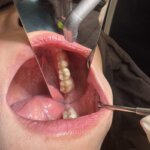 東大宮かきうち歯科